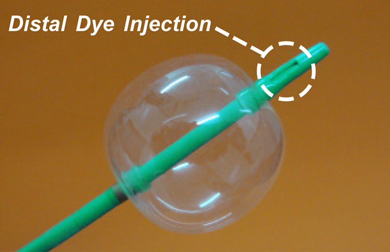 Distal_Dye_Injection_image